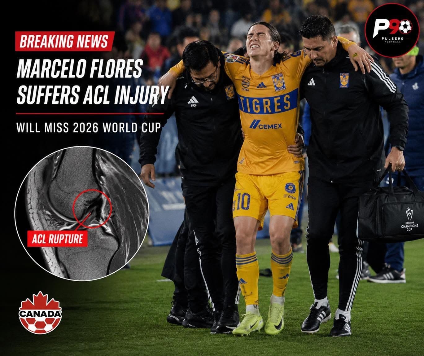 Understanding ACL Injuries, Recovery Timelines, and the Path to Return to Play